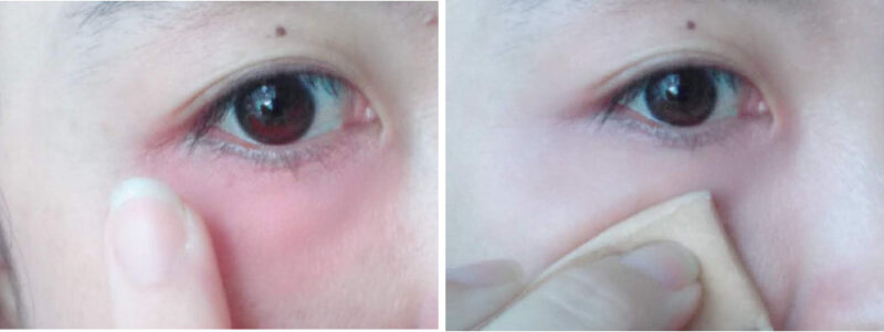 青クマ隠しにcoscosのオレンジコンシーラー口コミ 目元にふっくら血色感